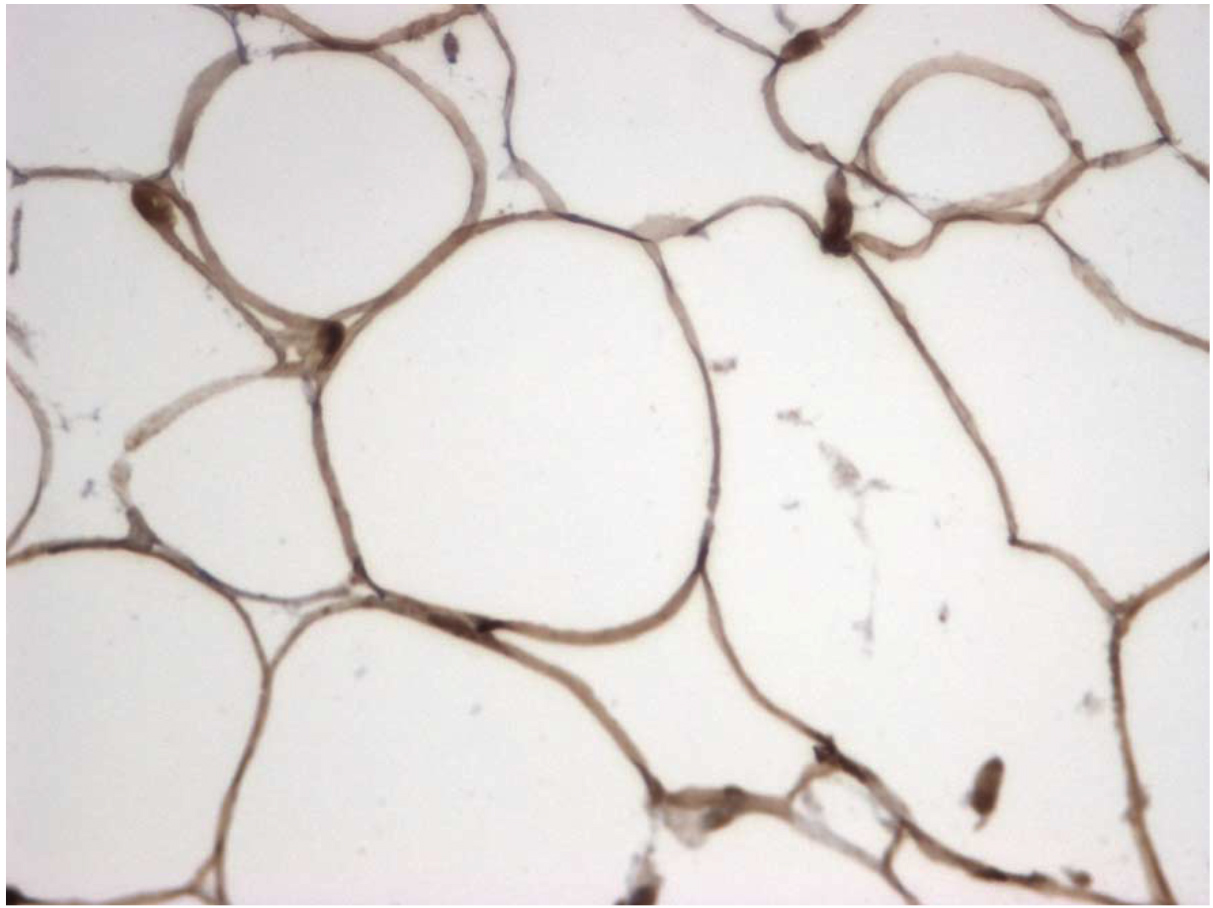 Immunohistochemical staining of human adipose tissue using MGL antibody (Cat. No. X2793P).  Antibody used at 2 µg/ml.  40x magnification.